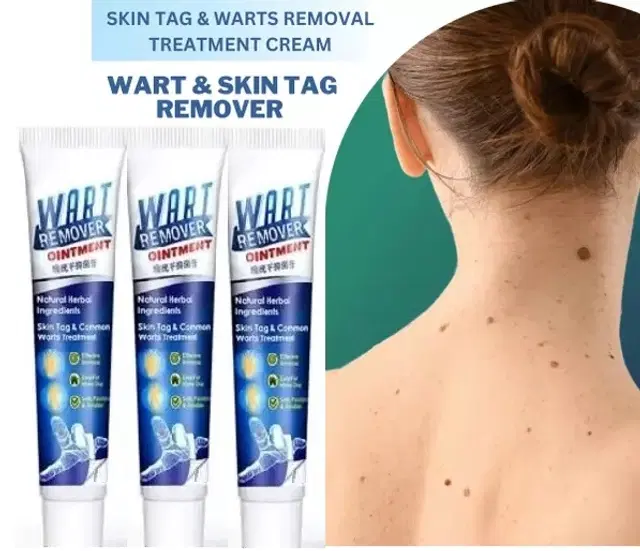 Wart Remover Cream, 100 g, Pack of 3