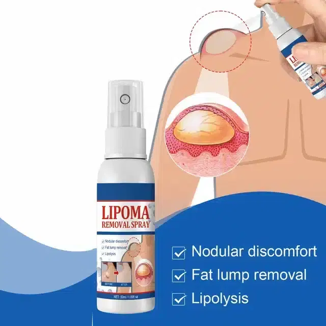 Feminela Lipoma Remover Spray, 60 ml