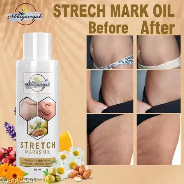 Abhigamyah Stretch Marks Removal Oil, 50 ml