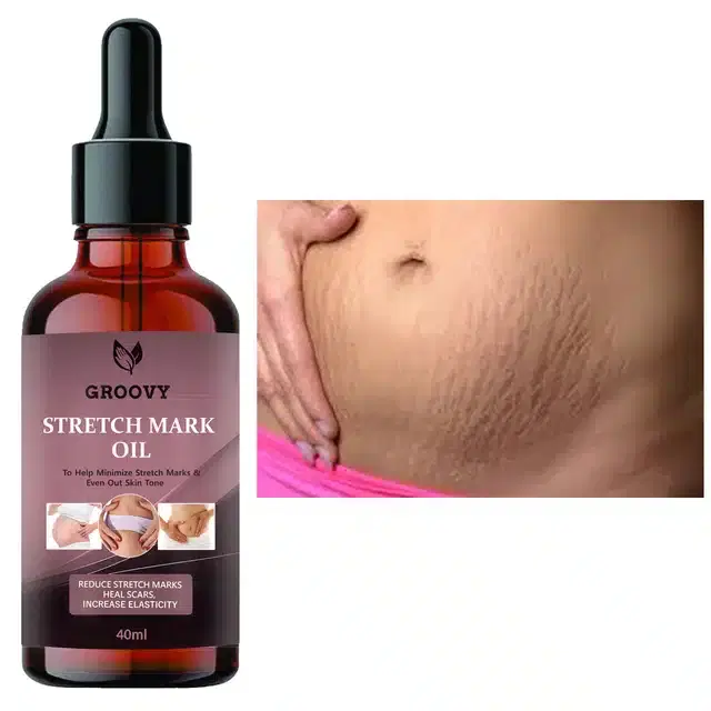 Groovy Stretch Marks Oil, 40 ml