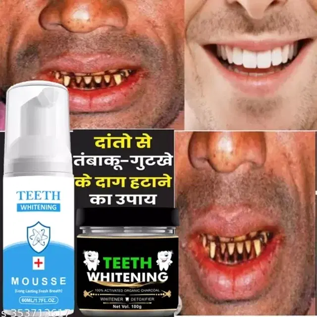 Activated Charcoal Teeth Whitening Toothpaste For Deeply Clean Gums Intensive Stain Removal Freash Breath, 60 Ml