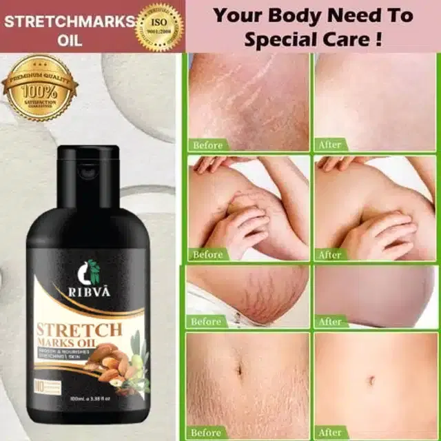 Ribva Stretch Marks Removal Oil, 100 ml
