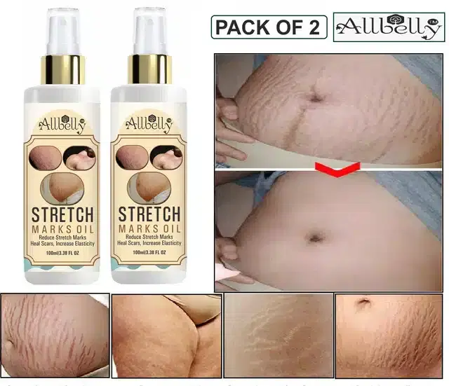 Allbelly Repair Stretch Mark Removal Oil, 100 ml, Pack of 2
