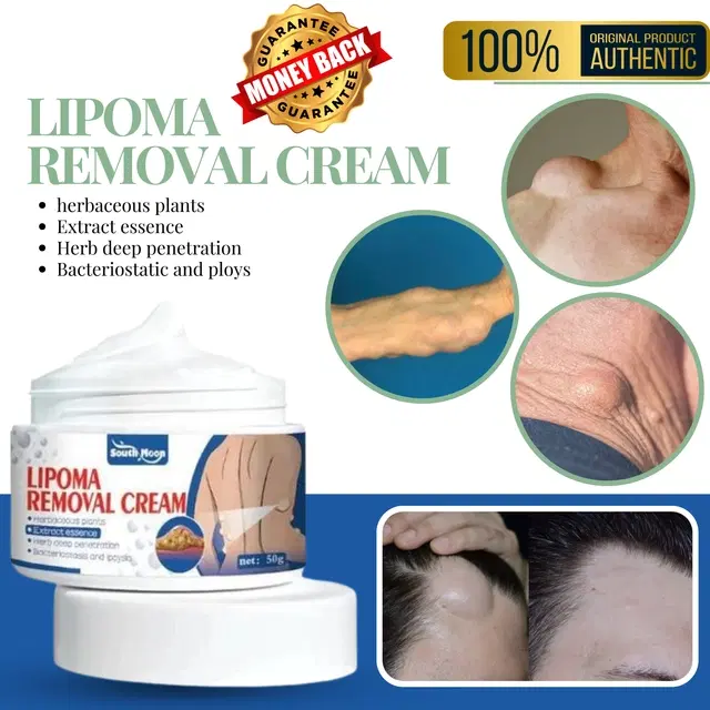 Lipoma Removal Cream, 50 g
