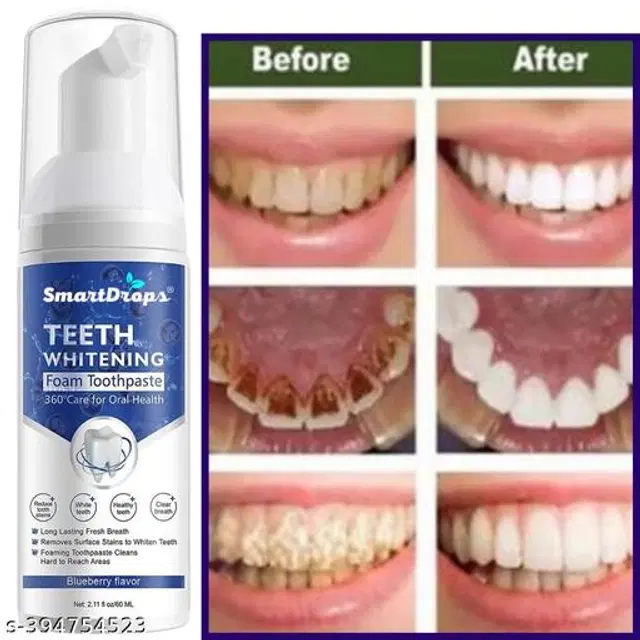 Smartdrops Teeth Whitening Foam, 60 ml