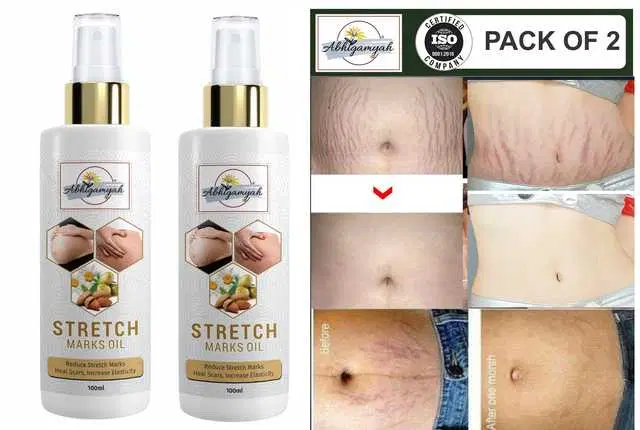 Abhigamyah Present Repair Stretch Marks Removal Natural Heal Pregnancy Breast, Hip, Legs, Mark Oil, 100 ml, Pack Of 2, A-992