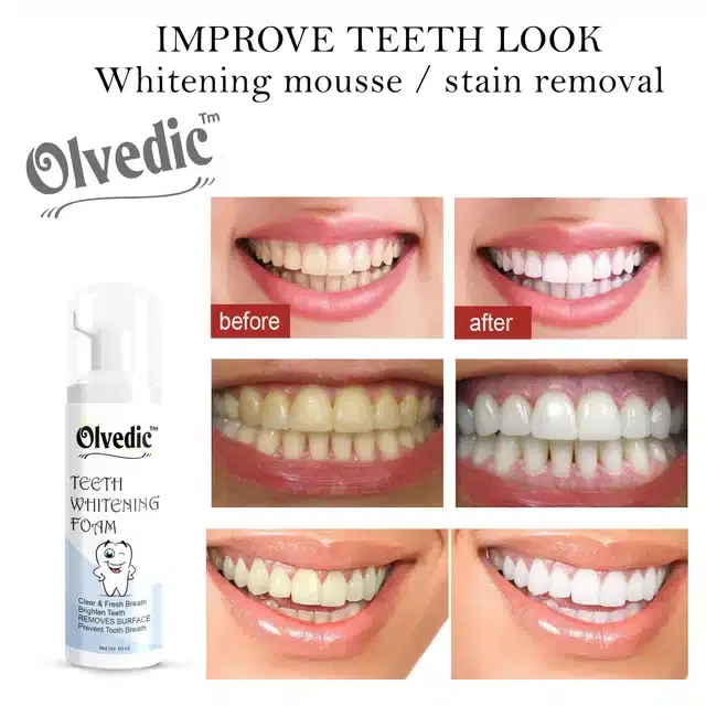 Olvedic Teeth Whitening Foam, 60 ml