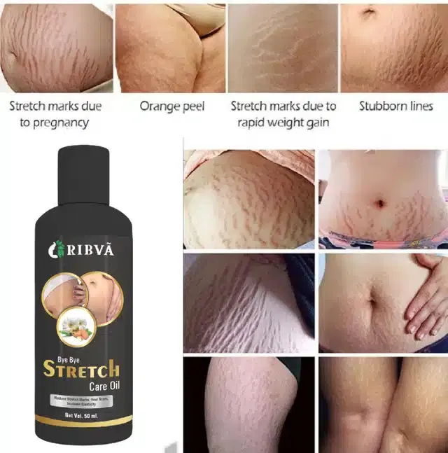 Ribva Stretch Marks Removal Oil, 50 ml