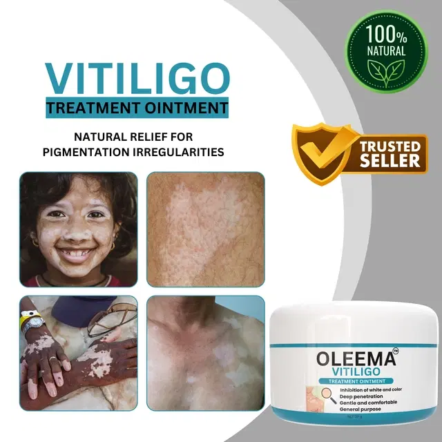 Vitiligo Treatment Ointment, 20 g