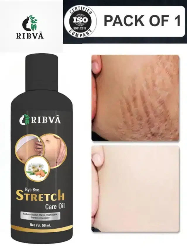Ribva Stretch Marks Removal Oil, 50 ml