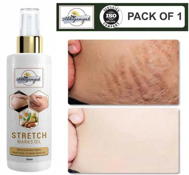 Abhigamyah Present Repair Stretch Marks Removal Natural Heal Pregnancy Breast, Hip, Legs, Mark Oil, 100 ml, Pack Of 1, A-985