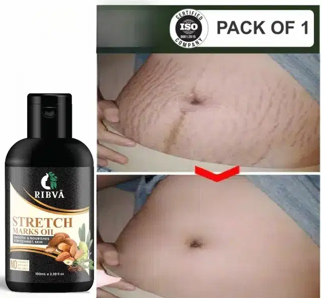 Ribva Stretch Marks Oil, 100 ml