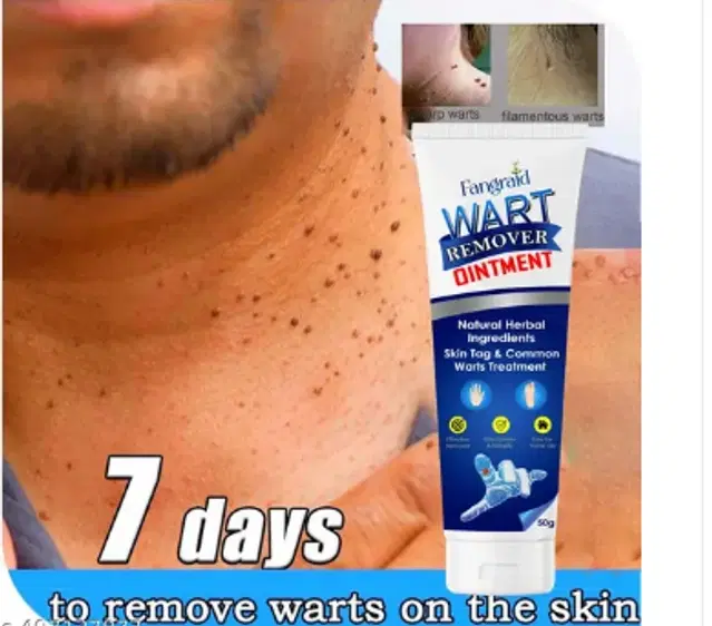Atemporal Warts Remover Cream, 100 g