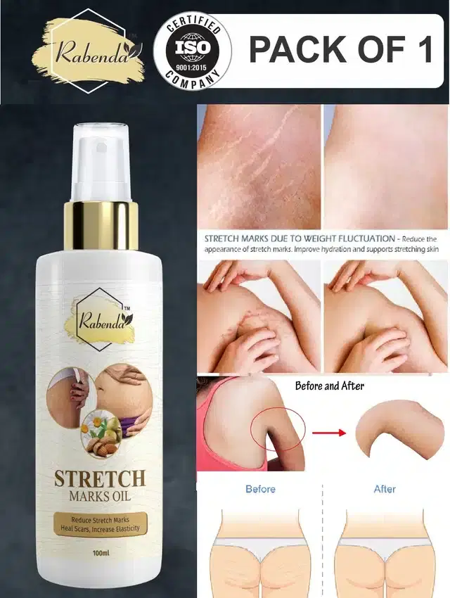 Rabenda Present Repair Stretch Marks Removal, 100 ml, Pack of 1, K-25