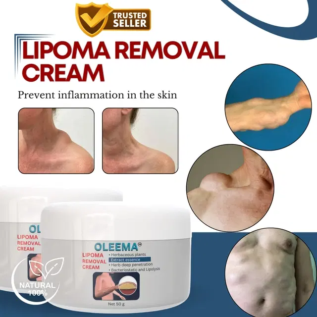 Lipoma Removal Cream, 50 g, Pack of 2