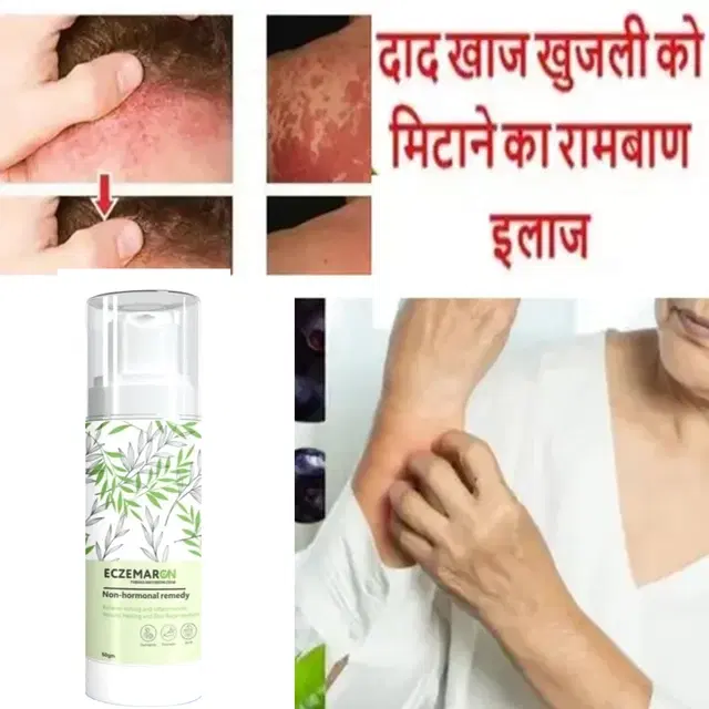 Feminela Herbal Eczemaron Itching Relief Cream, 50 g