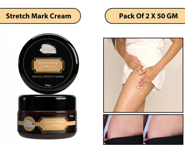 Stretch Marks Cream, Pack of 2, 50 g, KF-32