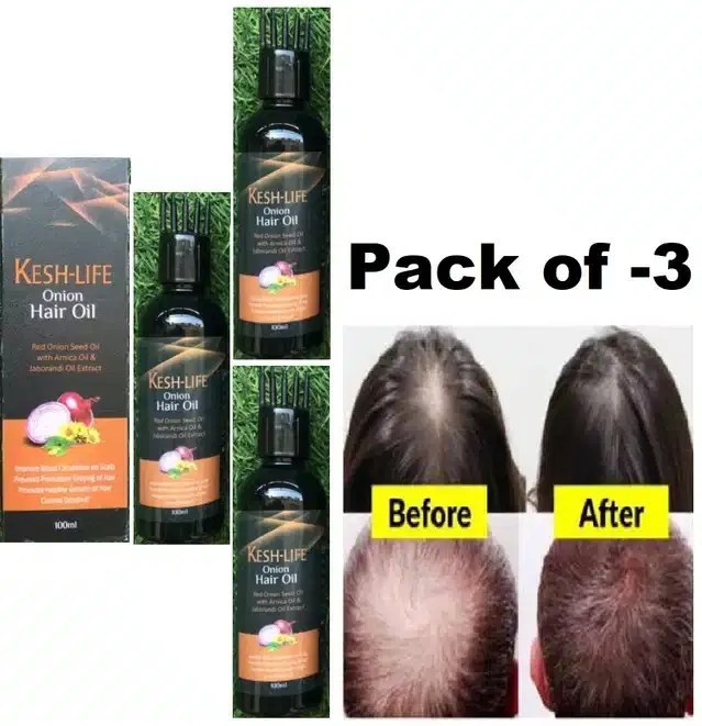 Kesh Life Onion Hair Oil, Pack of 3, 100 ml