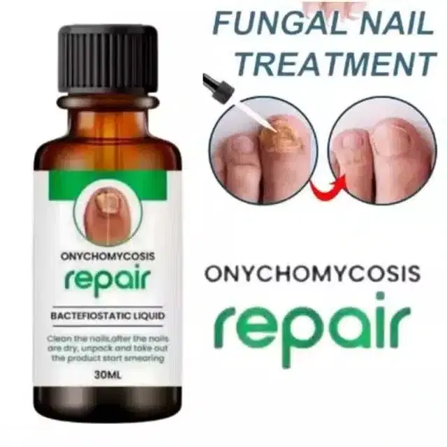 Fungal Nail Treatment, 30 ml
