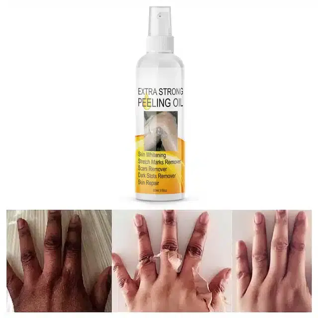 Newsio Skin Repair Extra Strong Peeling Oil, 60 ml