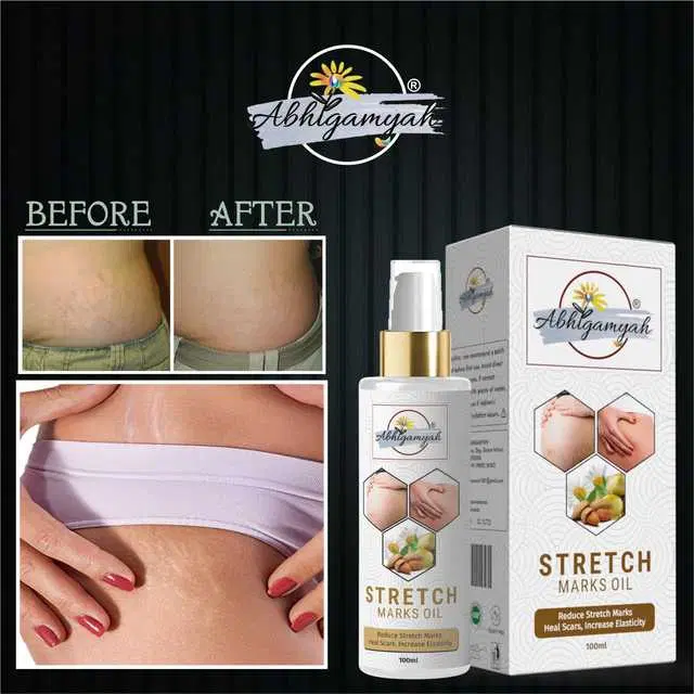 Abhigamyah Present Repair Stretch Marks Removal Natural Heal Pregnancy Breast, Hip, Legs, Mark Oil, 100 ml, Pack Of 1, A-957