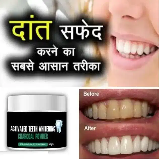 Teeth Whitening White Diamond Charcoal Powder, Black, 50 g