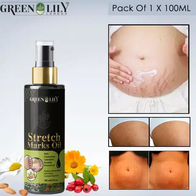 Green Lily London Stretch Marks Removal Oil, 100 ml
