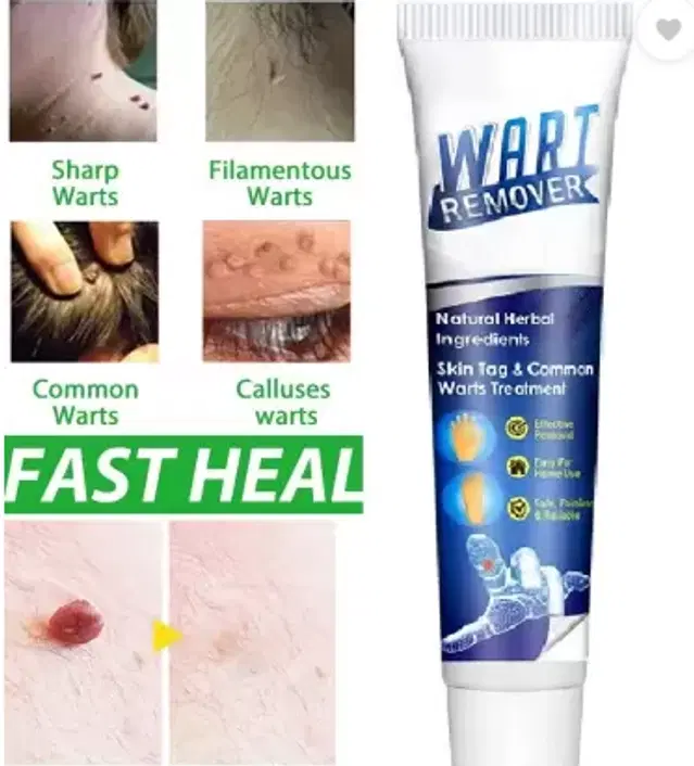 Atemporal Warts Remover Cream, 100 g