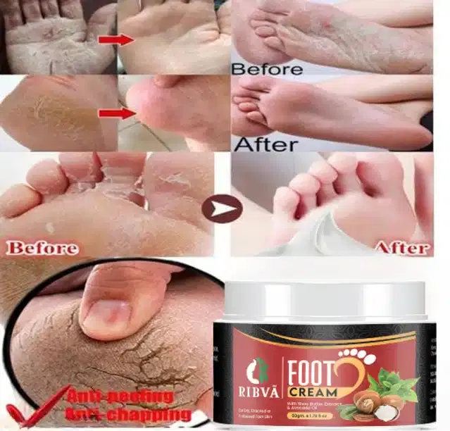 Ribva Foot Crack Care Cream, 50 g