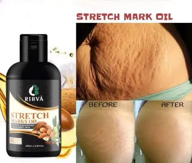 Ribva Body Stretch Marks Remover Oil, 100 ml
