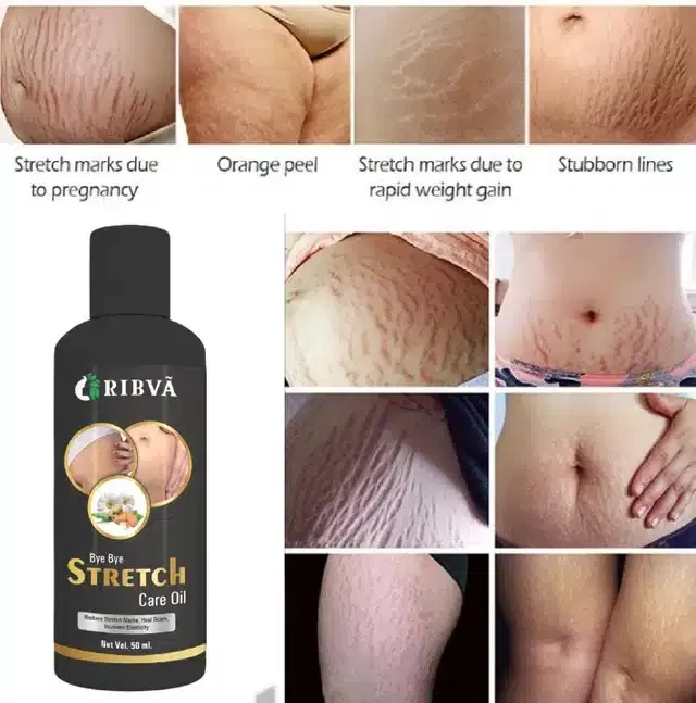 Ribva Stretch Marks Removal Oil, Reduce Scar, 50 ml