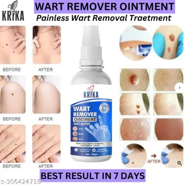 KRIKA Wart Remover Ointment, 50 g