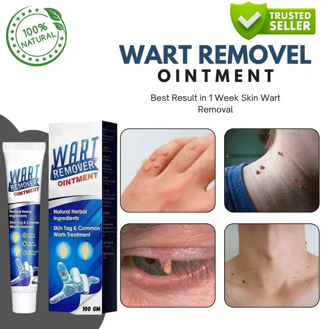 Wart Removal Ointment, 100 g