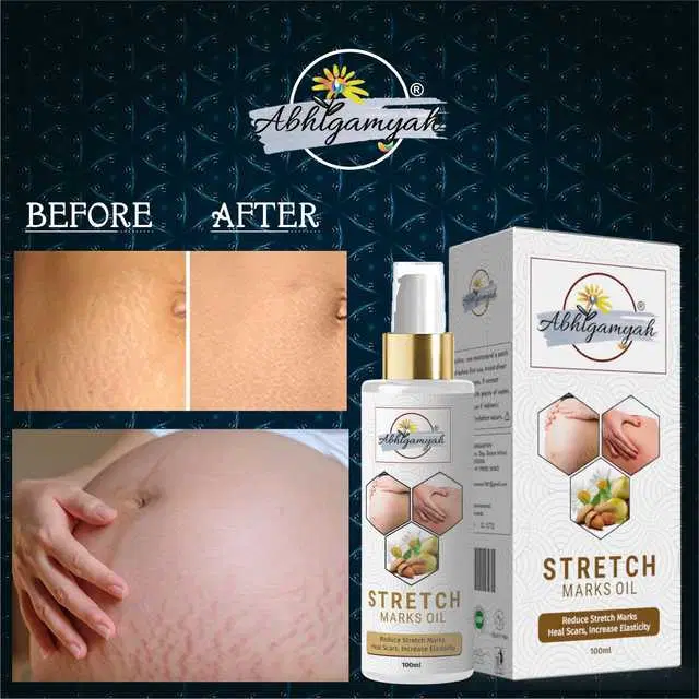 Abhigamyah Present Repair Stretch Marks Removal Natural Heal Pregnancy Breast, Hip, Legs, Mark Oil, 100 ml, Pack Of 1, A-967