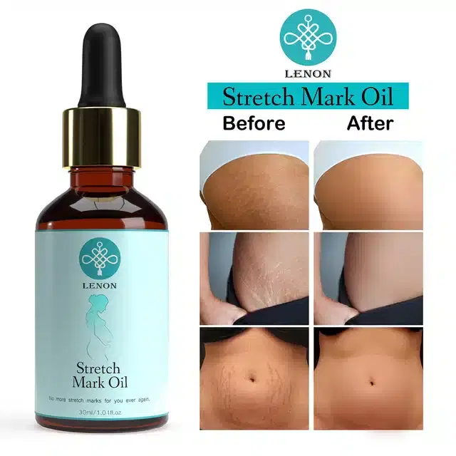 Lenon Stretch Mark Removal Oil, 30 ml, S-05