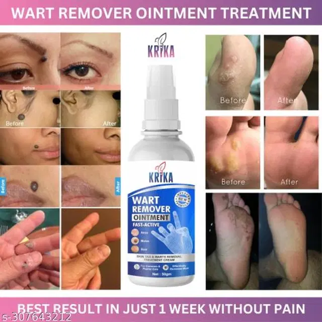 KRIKA Wart Remover Ointment, 50 g
