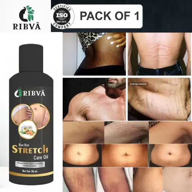 Ribva Body Stretch Marks Remover Cream, 50 ml
