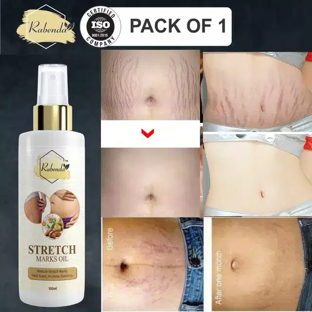 Rabenda Stretch Marks Removal Oil, Pack of 1, 100 ml, ZT-19
