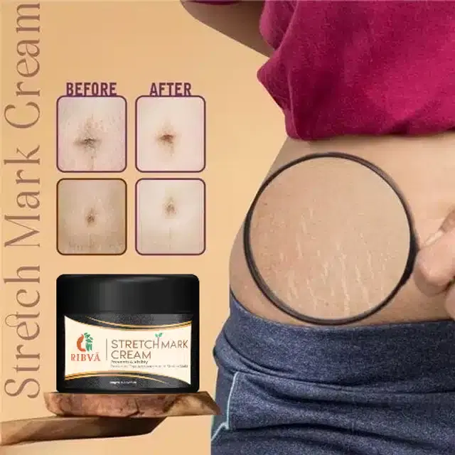 Ribva Stretch Marks Cream, 100 g
