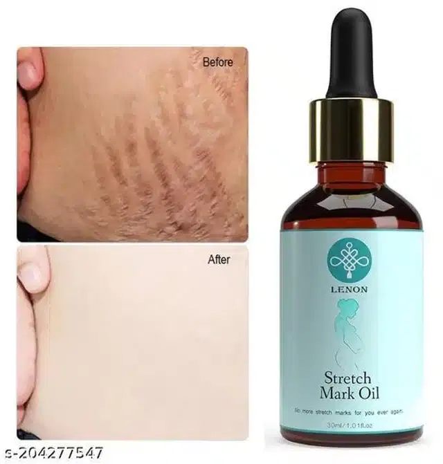 Lenon Stretch Mark Oil