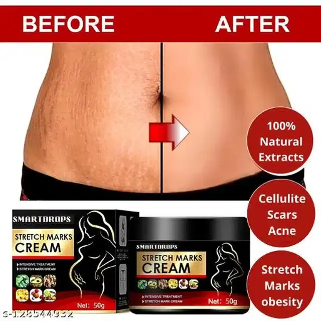 Phillauri Stretch Marks Creams for Men & Women, 50 g