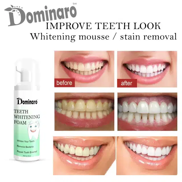 Dominaro Teeth Whitening Foam, 60 ml