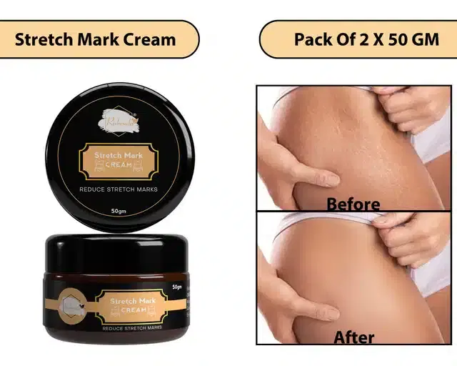 Rabenda Stretch Marks Cream to Help Minimize Stretch Marks & Even Out Skin tone, 50 g, Pack of 2, K-32