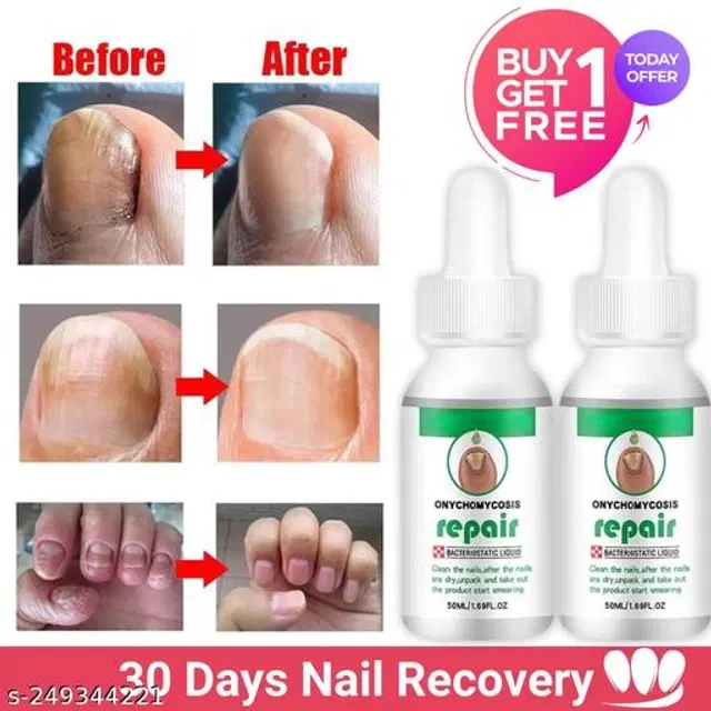 Onychomycosis Nail Serum, 30 ml, Pack of 2