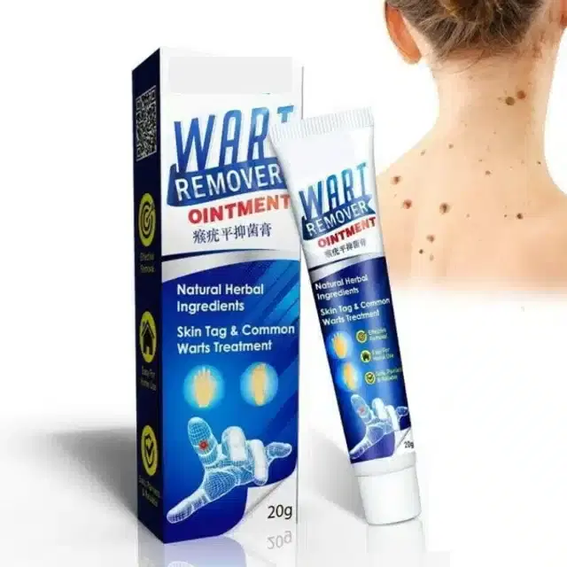 Wart Remover Ointment, 20 g