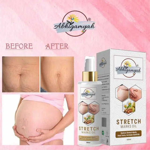 Abhigamyah Present Repair Stretch Marks Removal Natural Heal Pregnancy Breast, Hip, Legs, Mark Oil, 100 ml, Pack Of 1, A-971