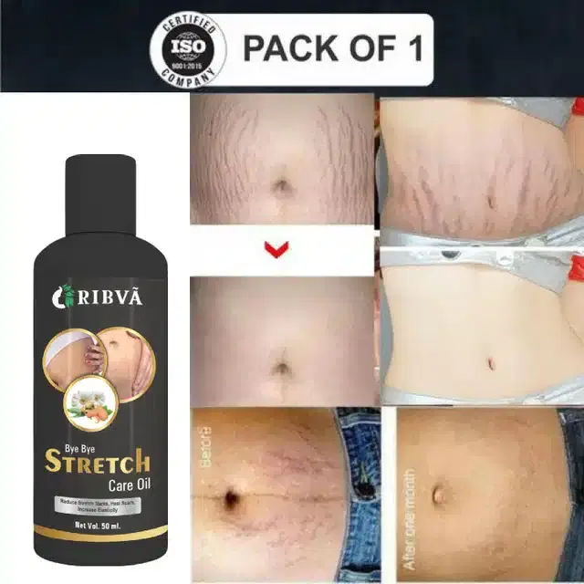 Ribva Stretch Marks Oil, 50 ml