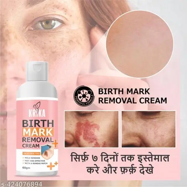 Krika Birthmark Removal Cream, 60 ml