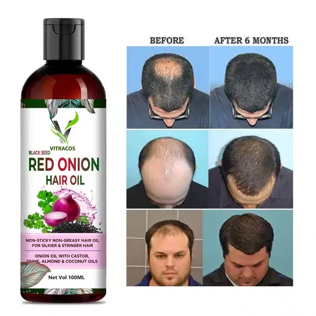 Vitracos Black Seed Red Onion Hair Oil, 100 ml