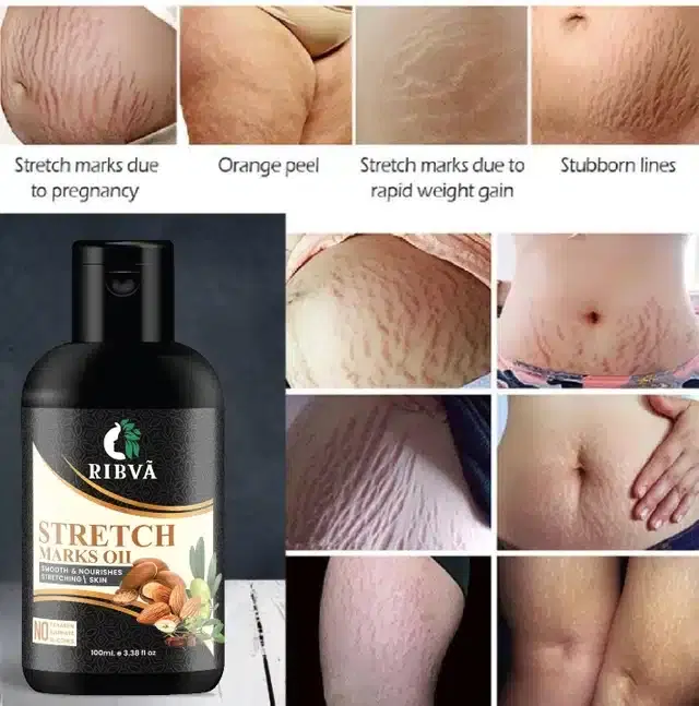 Ribva Stretch Marks Removal Oil, 100 ml